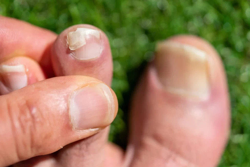 Integrating Professional Pedicures into Your Prevention Strategy 