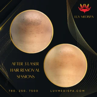 Instagram post from luv_medispa. This post is in position 5.