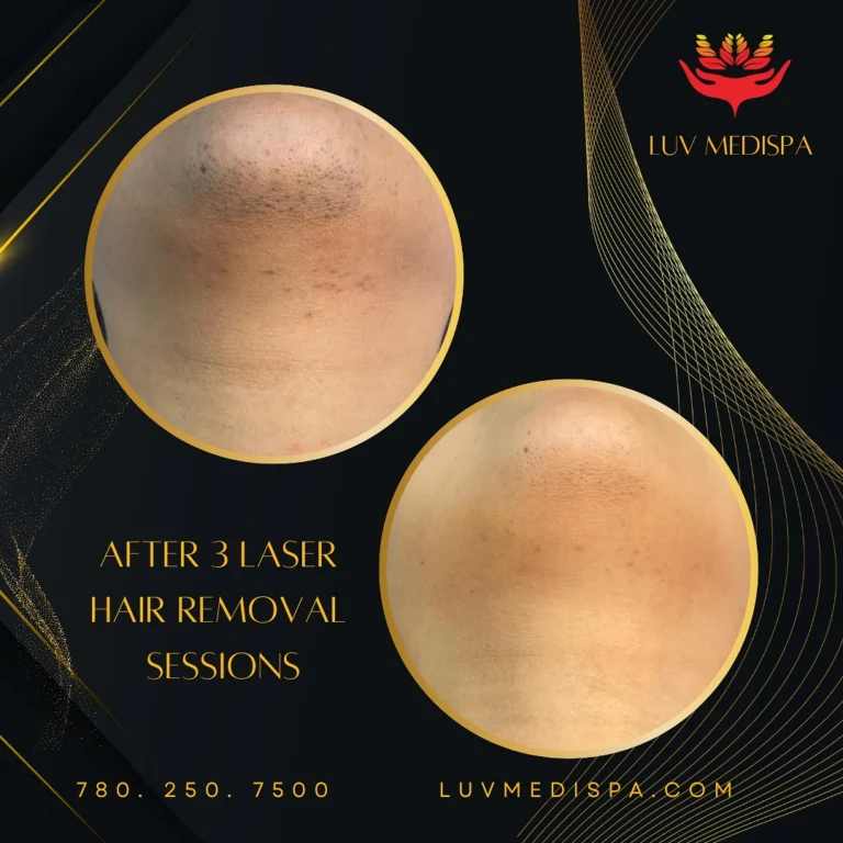 Instagram post from luv_medispa. This post is in position 4.