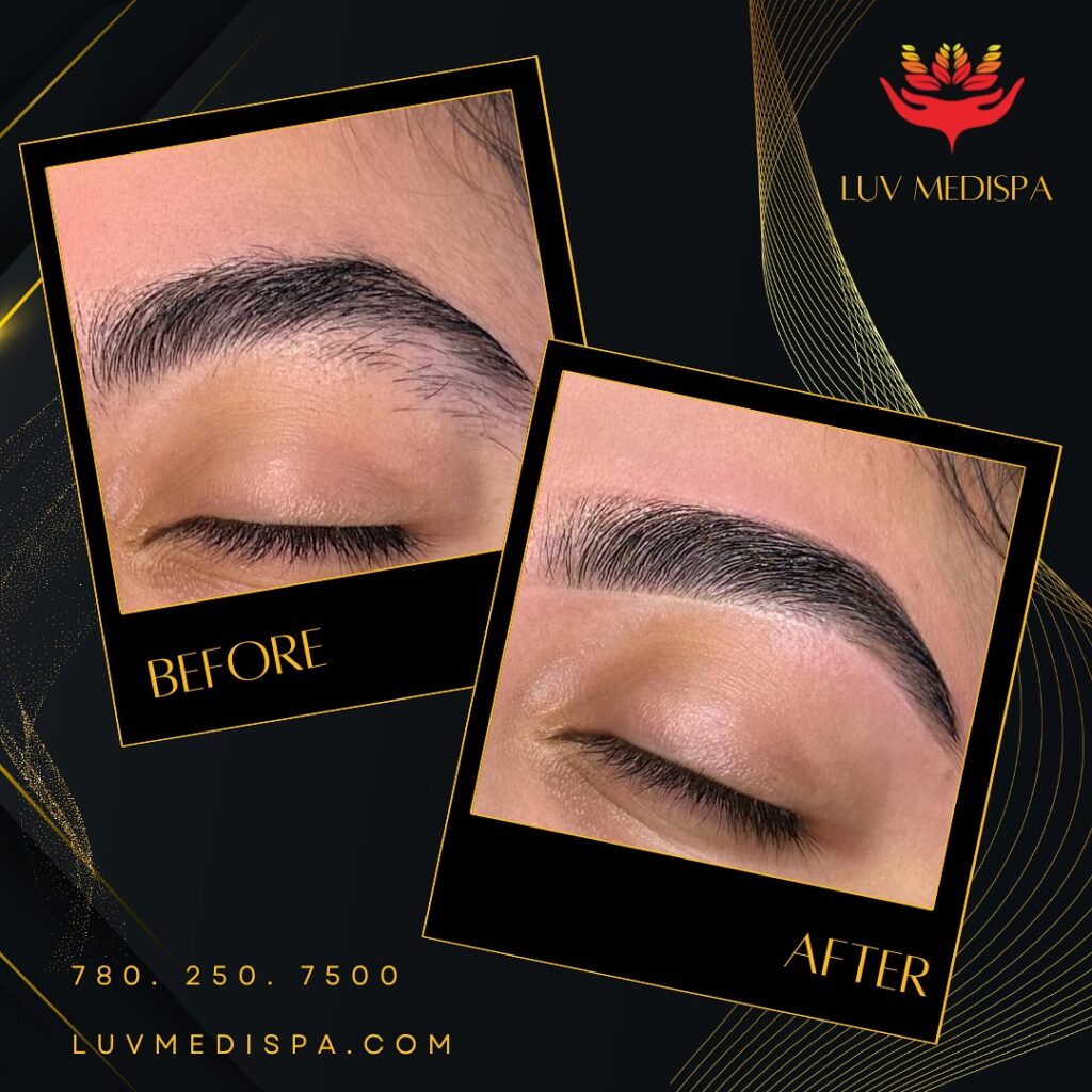 Instagram post from luv_medispa. This post is in position 8.