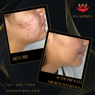 Instagram post from luv_medispa. This post is in position 6.