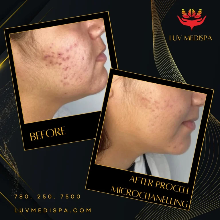 Instagram post from luv_medispa. This post is in position 5.