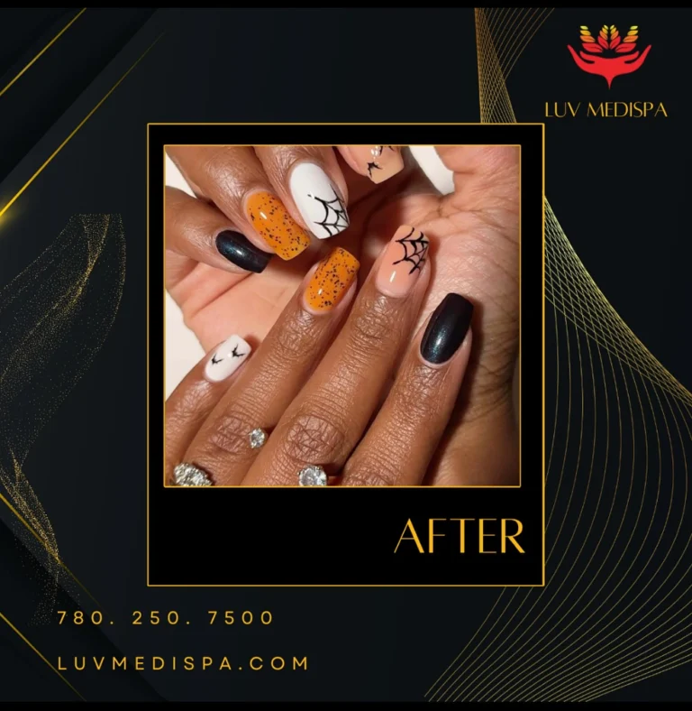 Instagram post from luv_medispa. This post is in position 1.