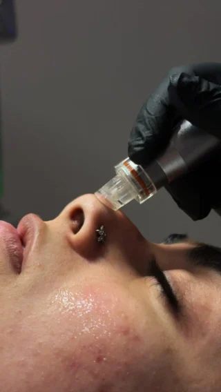 Instagram post from luv_medispa. This post is in position 1.